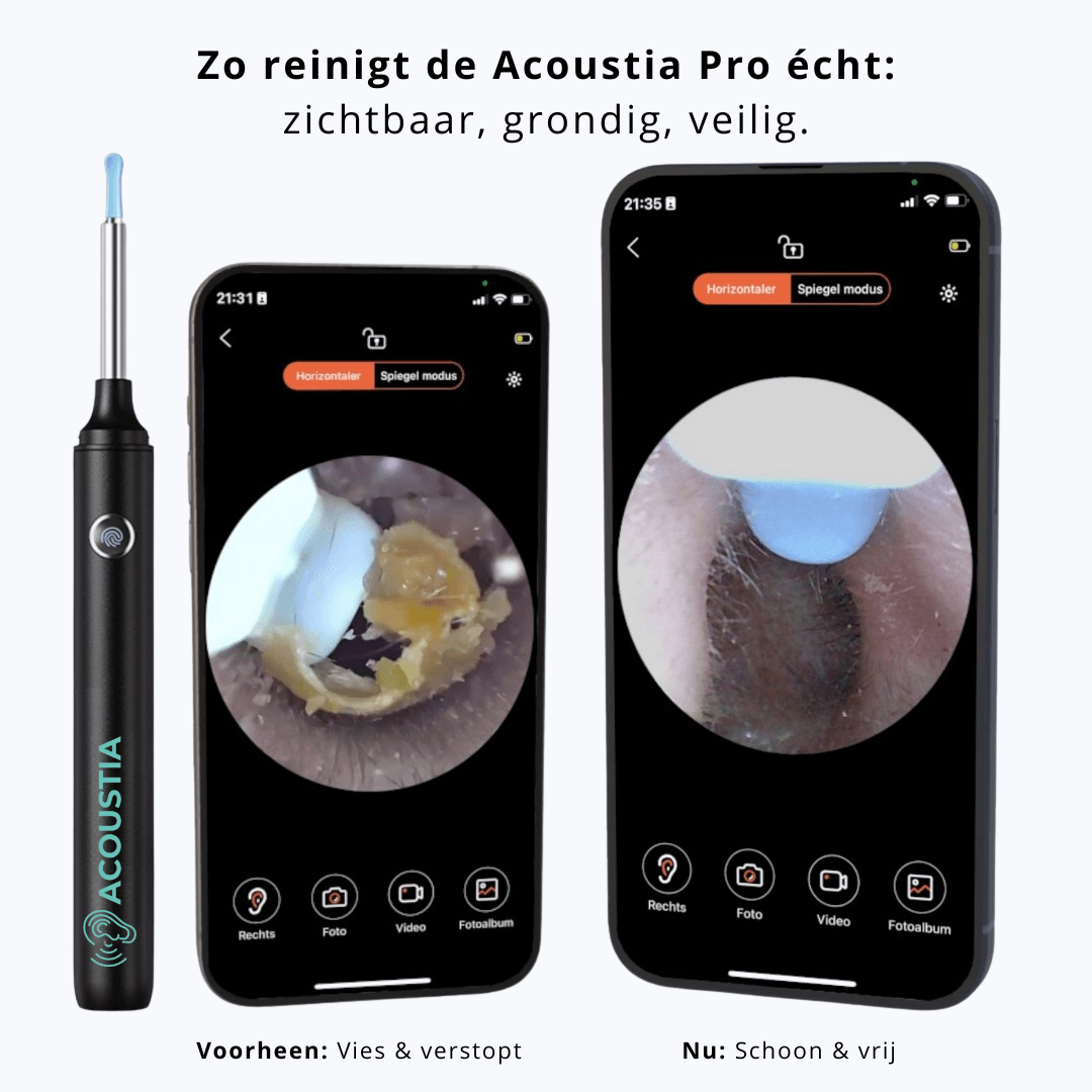 Acoustia Pure