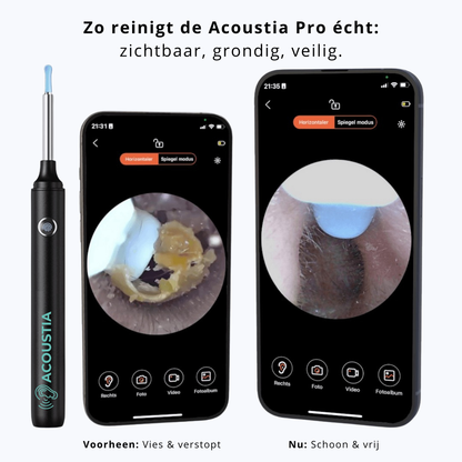 Acoustia Pure